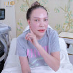 Ca Sĩ Thanh Hà Xóa xăm và xăm môi mày mới tại Rio Beauty Clinic