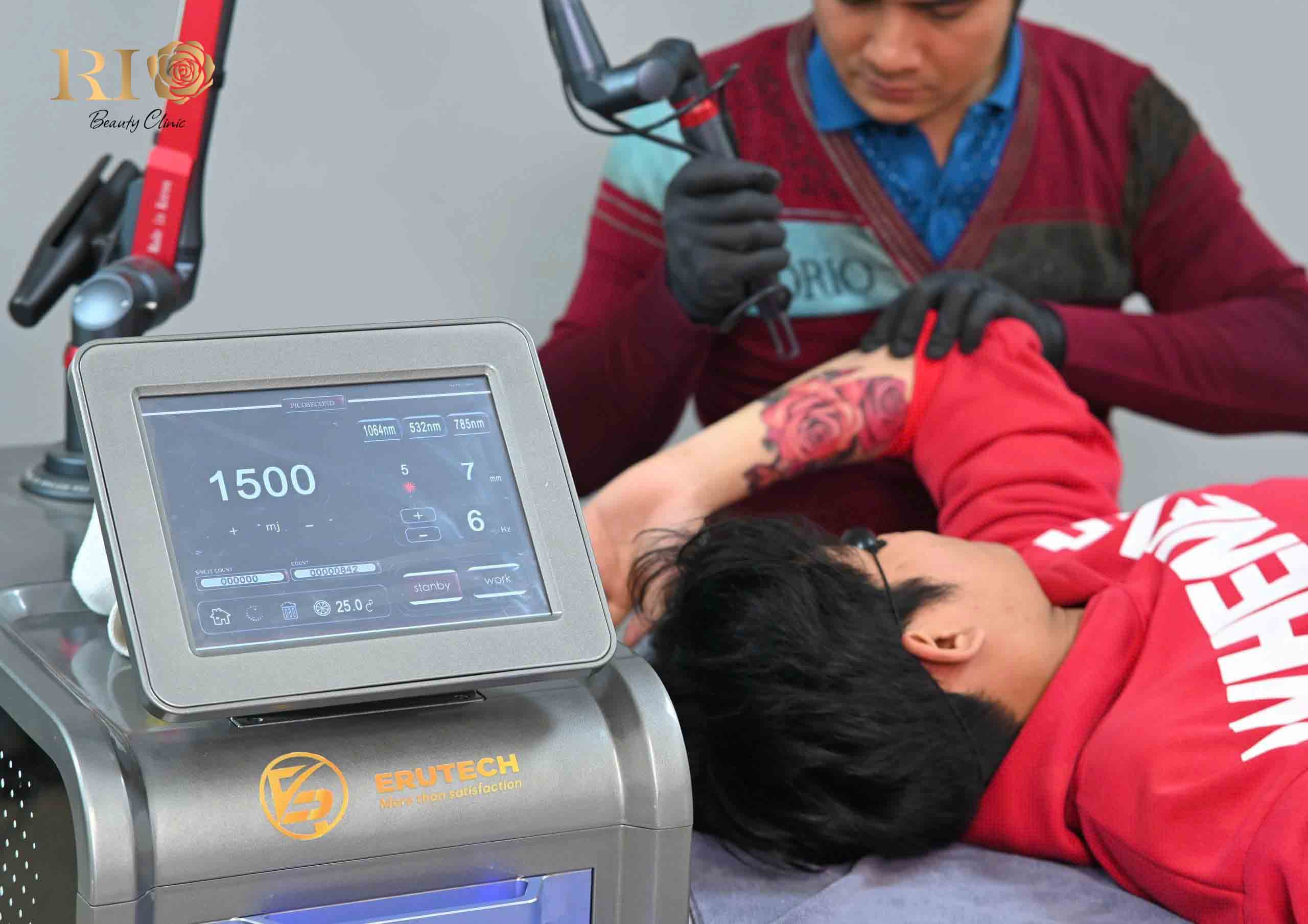 Minh họa quy trình xóa hình xăm hiện đại giúp giảm cảm giác đau và tăng sự thoải mái cho khách hàng