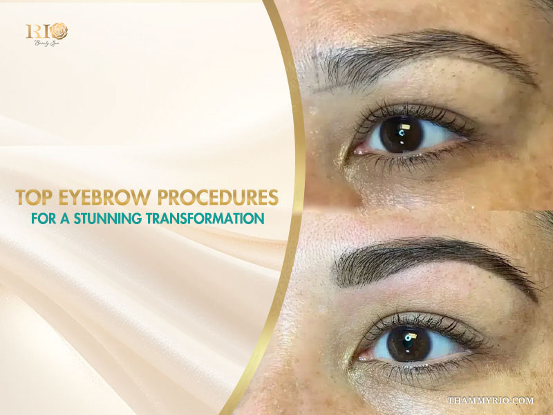 Professional eyebrow procedures before and after results at Rio Beauty Spa.