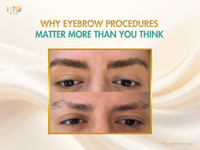 Close-up comparison of eyebrow procedures showing enhanced density and shape.