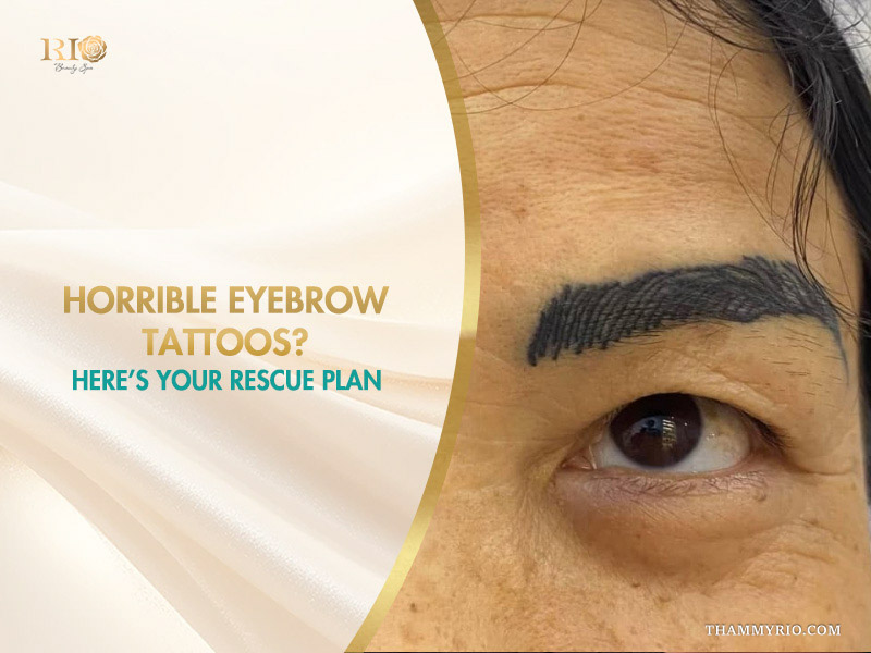 A rescue plan for horrible eyebrow tattoos featuring thick and dark over-tattooed ink.