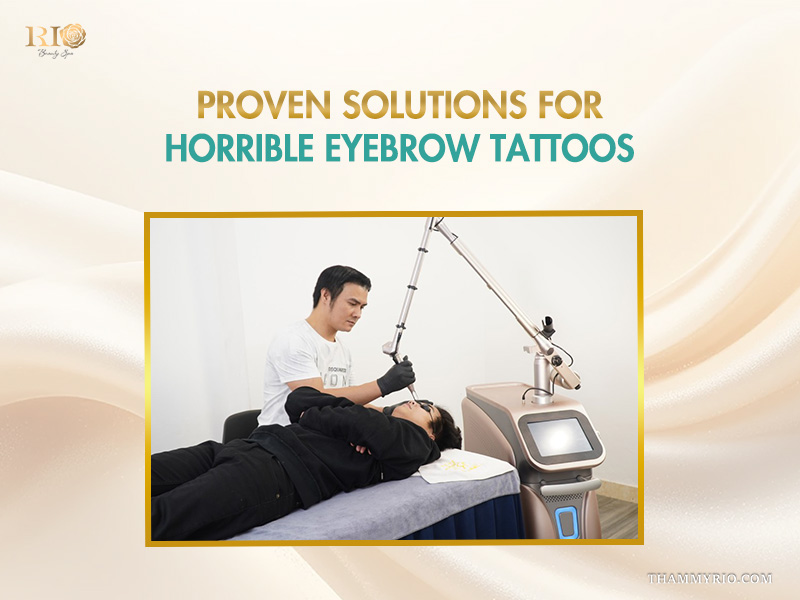 A specialist using advanced laser technology to treat horrible eyebrow tattoos at Rio Beauty Clinic.