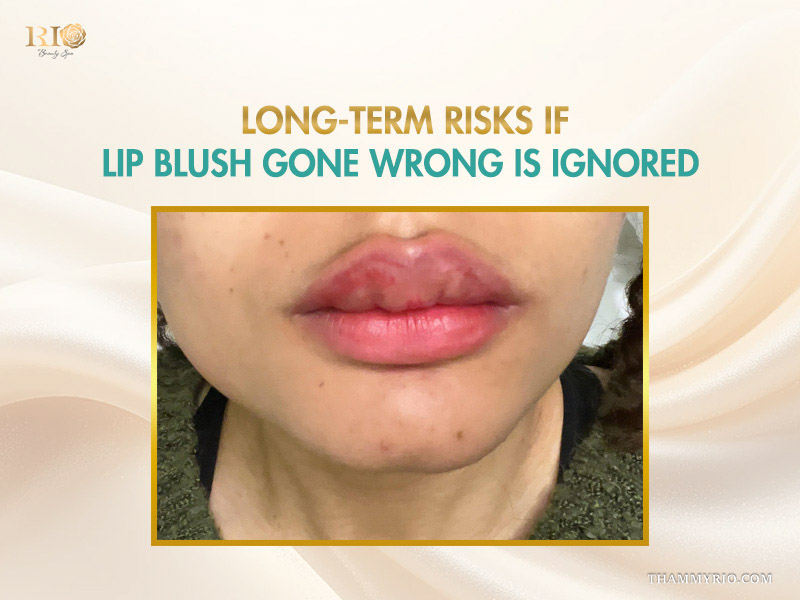Close-up of severely dark and patchy lips illustrating a lip blush gone wrong case.