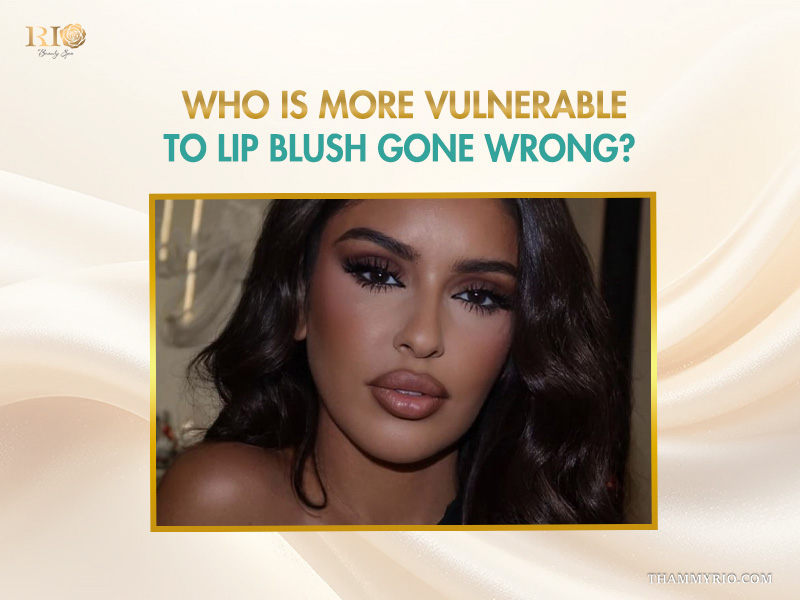 A woman with dark skin tones who may be more vulnerable to a lip blush gone wrong.