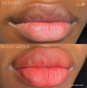 Professional lip blushing on dark lips result showing melanin neutralization with a balanced natural tone.