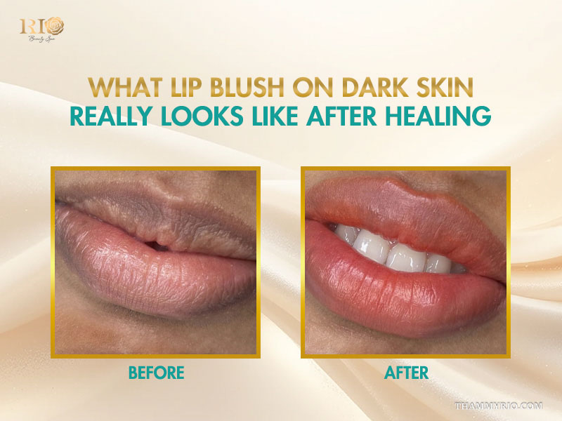 Before and after results of lip blushing on dark lips showing healed natural pink color.