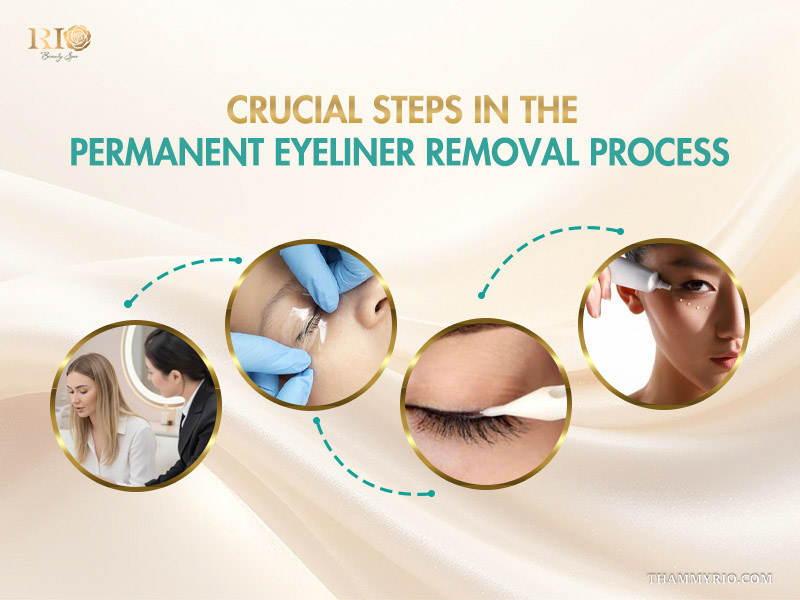 Crucial steps in the professional process of removing permanent eyeliner at a clinic.