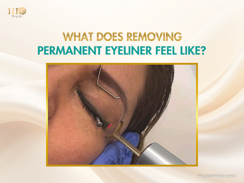 A patient undergoing a laser session for removing permanent eyeliner with protective eye shields.