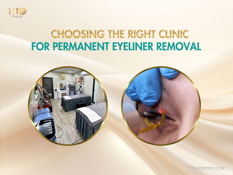 Professional treatment room and laser procedure for removing permanent eyeliner at a reputable clinic.