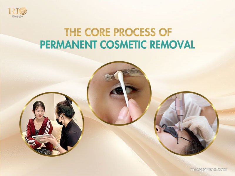 Step-by-step core process of removing permanent makeup including consultation and laser treatment.