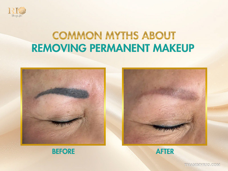 Before and after comparison of removing permanent makeup debunking common myths.