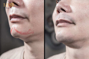 Xăm chân râu phong thủy giúp nam giới tăng vẻ nam tính và thu hút tài lộc tại Thẩm Mỹ Rio