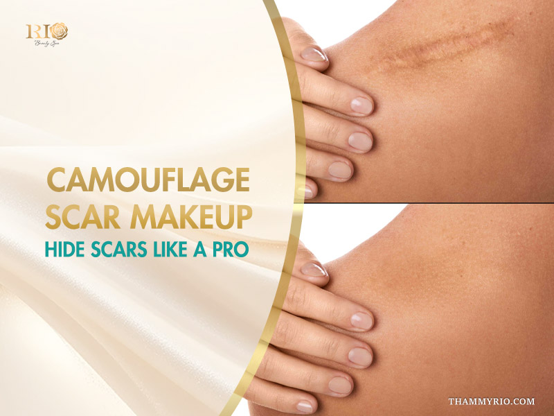 Before and after comparison of camouflage scar makeup applied to a surgical scar on the arm.