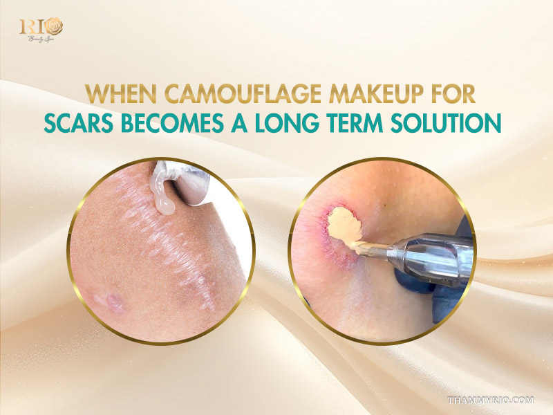 Comparison of camouflage scar makeup as a long term solution showing scar treatment and pigment application.
