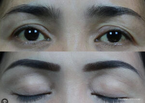Correction microblading guide for restoring natural brows 8 - Thẩm Mỹ Rio Beauty Clinic