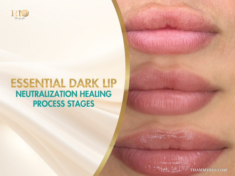 Visual guide showing the dark lip neutralization healing process stages at Rio Beauty Spa.
