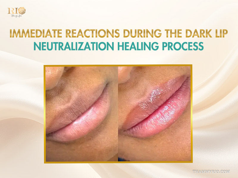 Step-by-step dark lip neutralization healing process timeline from before to one month.