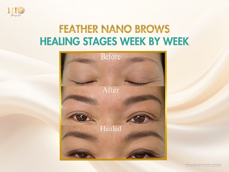 Before and after results of feather nano brows showing the healing stages from initial procedure to fully healed.