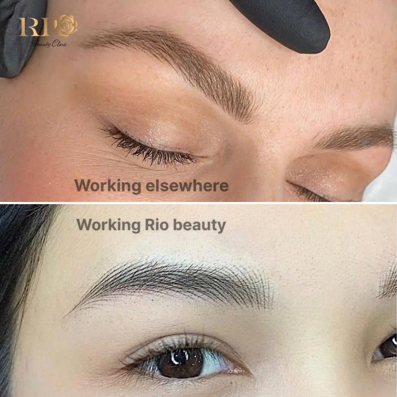 The clear difference: Masterful feathering tattoo at Rio Beauty Clinic vs. standard PMU.