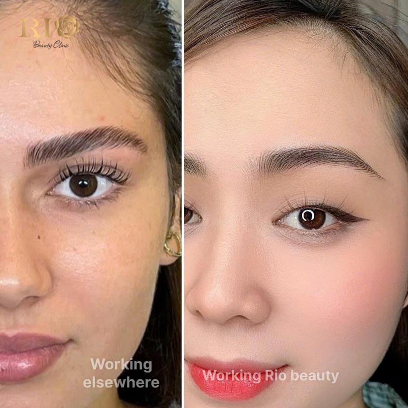 Close-up of fine hair-strokes in a masterful feathering tattoo at Rio Beauty Clinic.