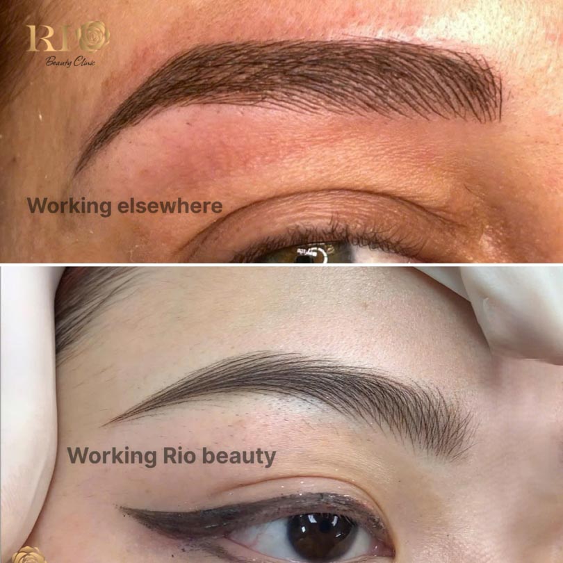 Achieving natural eyebrow beauty with a masterful feathering tattoo at Rio Beauty Clinic.