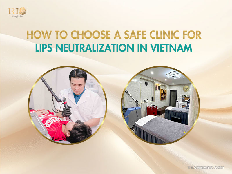 Choosing safe lip neutralization at Rio Beauty Spa Vietnam: laser procedure on patient and clinic room views.