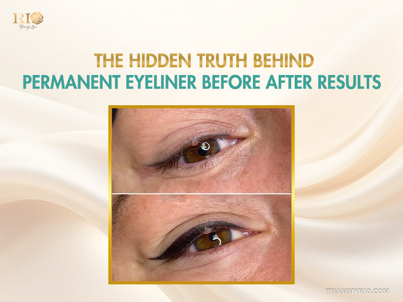 Permanent eyeliner before after quality at Rio Beauty Clinic
