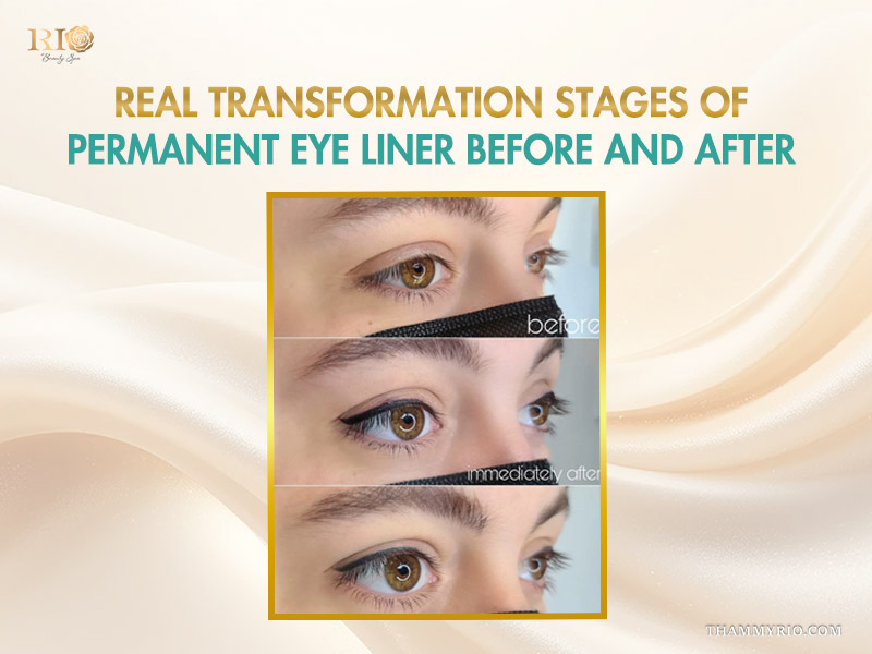 Permanent eyeliner before after transformation stages at Rio.