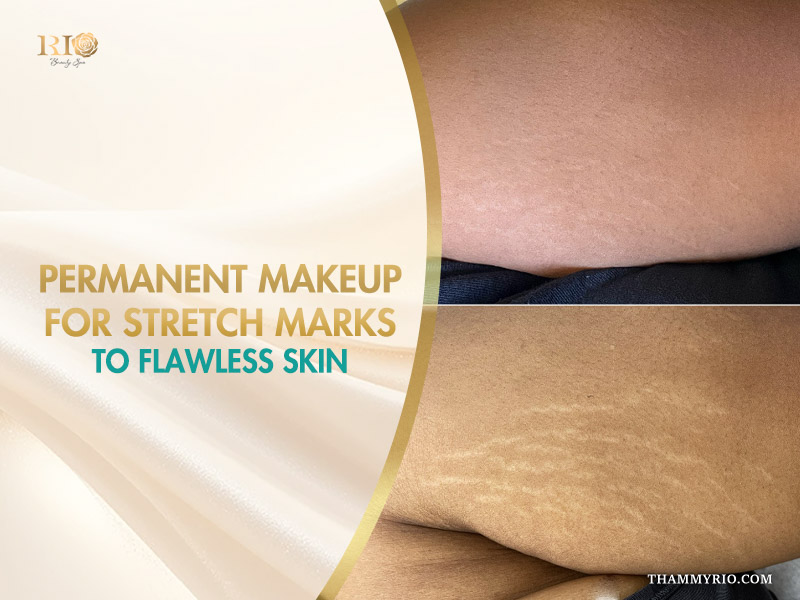 Before and after comparison of permanent makeup for stretch marks treatment on skin