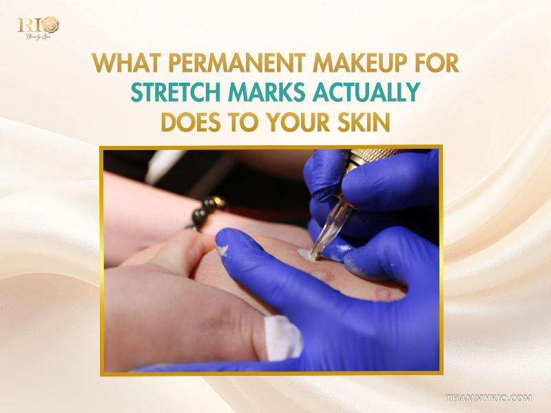 Professional permanent makeup for stretch marks procedure being performed on skin using a specialized tattoo device and skin-tone pigments.