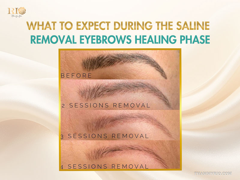 Comparison of saline removal for microblading results after 2, 3, and 4 sessions.