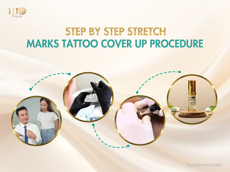 A multi-stage diagram illustrating the procedure for stretch mark tattoo cover up and scar camouflage on dark skin, including consultation, pigment selection, application, and final product.
