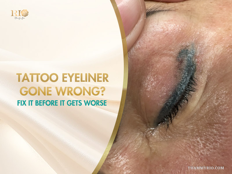 Close-up of tattoo eyeliner gone wrong with ink migration and blurred lines on the upper eyelid.