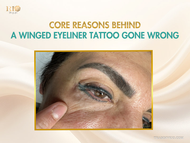 A winged eyeliner tattoo gone wrong with heavy blue ink migration and blurred tail on the outer corner of the eye.