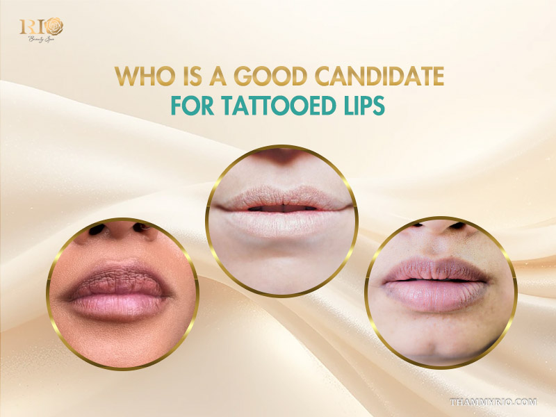 Comparison of uneven, pale, and dark pigmented lips as candidates for lipstick tattoo.