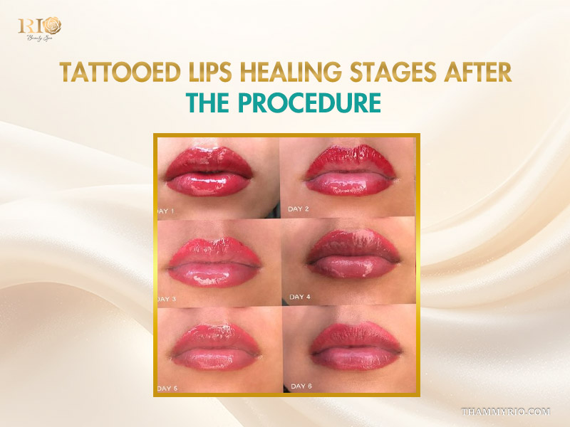 Six-day progression showing the lipstick tattoo healing stages from swelling to final natural pigment.