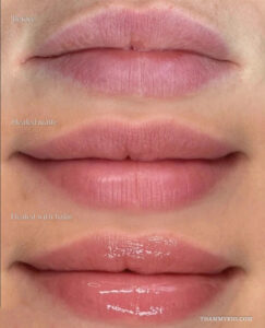 Comparison of lips before and after lipstick tattoo showing healed matte and glossy balm results.