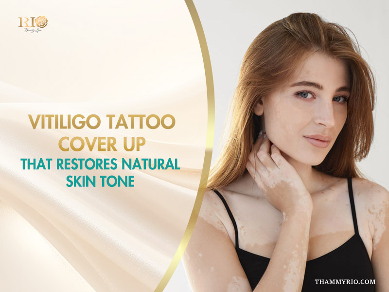 A young woman with vitiligo spots poses with her hand to her neck for a vitiligo tattoo cover up advertisement.