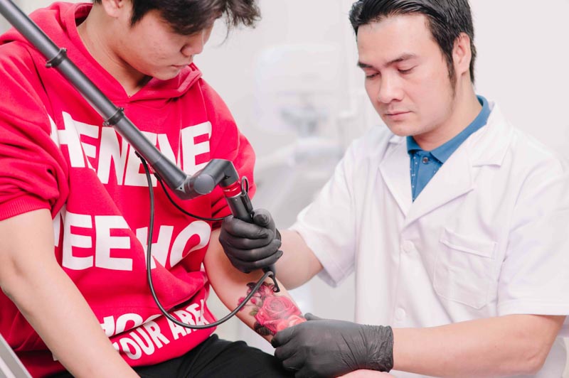 Laser Tattoo Removal 1 - Thẩm Mỹ Rio Beauty Clinic