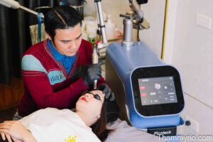 Treating Melasma and Nevus of Ota using Picotech Advance Laser 755nm technology at Rio Beauty Clinic.