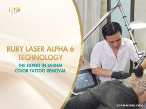 Mechanism of máy xóa hình xăm nhiều màu Ruby Laser Alpha 6 with 694nm wavelength for multi-color tattoo removal