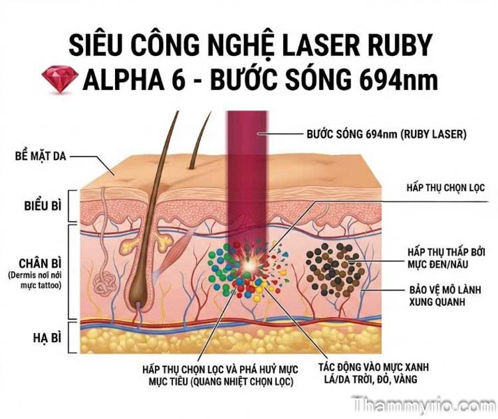 Selective photothermolysis of Ruby Laser Alpha 6 with 694nm wavelength for multi-color tattoo removal