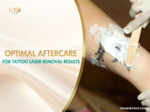 Detailed shot of a gloved hand applying aftercare cream to a leg tattoo area after a laser removal treatment at Rio Beauty Spa.