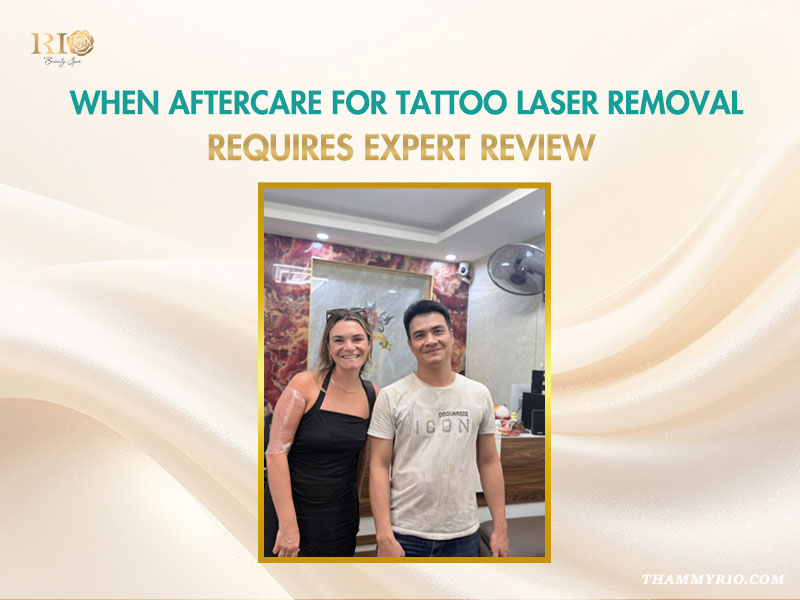 A professional expert standing with a female client after a session of aftercare for tattoo laser removal review.