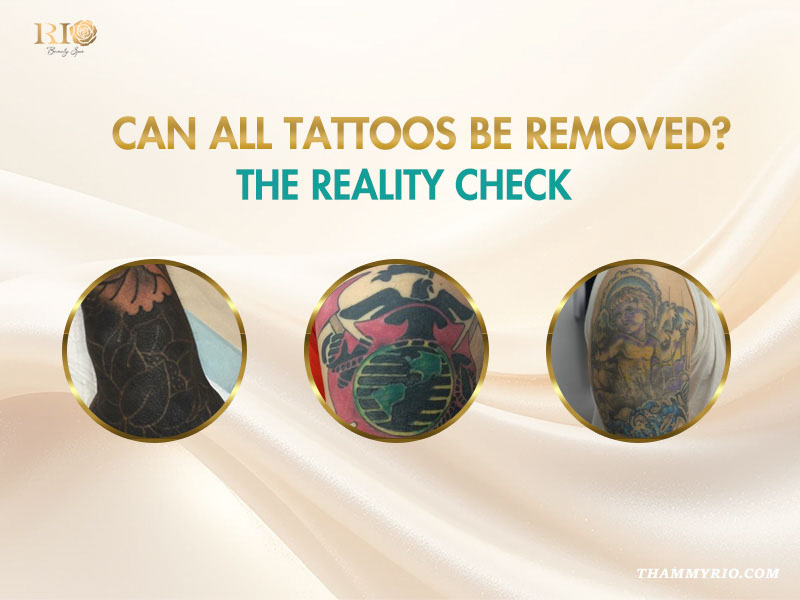 Three different complex tattoos illustrating the reality check of can all tattoos be removed.