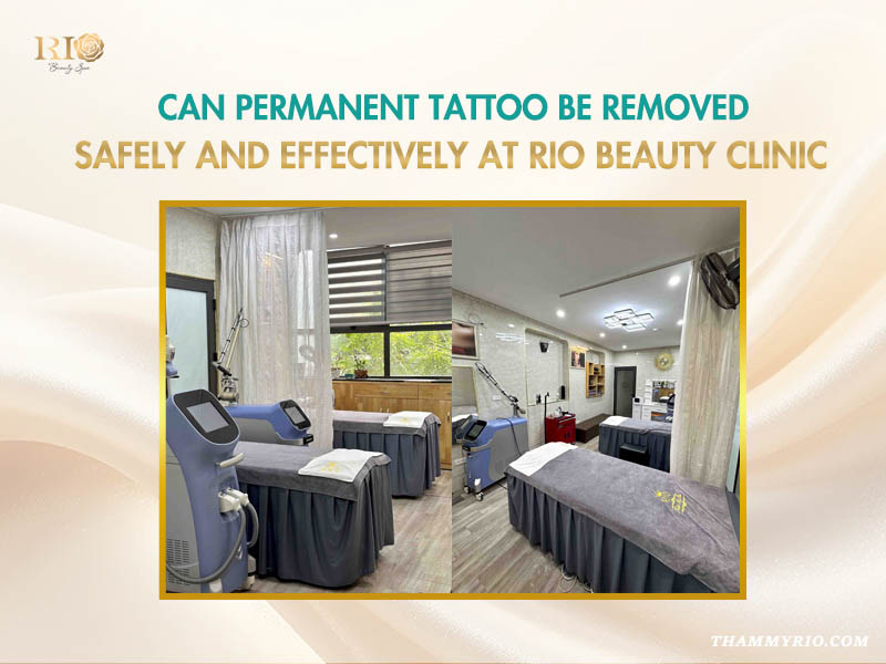 Professional treatment rooms and advanced laser technology at Rio Beauty Clinic to address can all tattoos be removed.