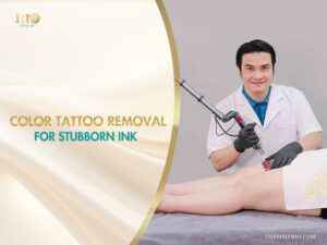 Professional laser color tattoo removal for stubborn ink at Rio Beauty Spa.