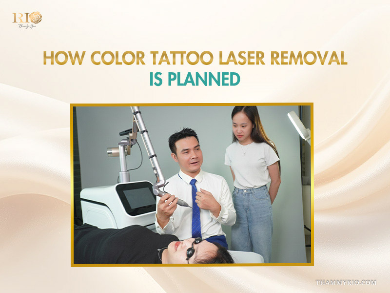 A specialist explaining the color tattoo removal process to a client using advanced laser equipment.