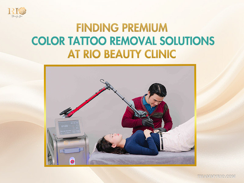 technician performing a color tattoo removal procedure on a client using premium laser technology at Rio Beauty Clinic.