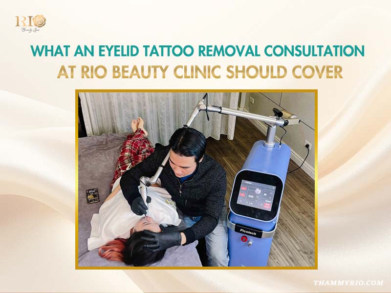 A technician using a laser machine for eyeliner tattoo removal on a client at Rio Beauty Clinic.